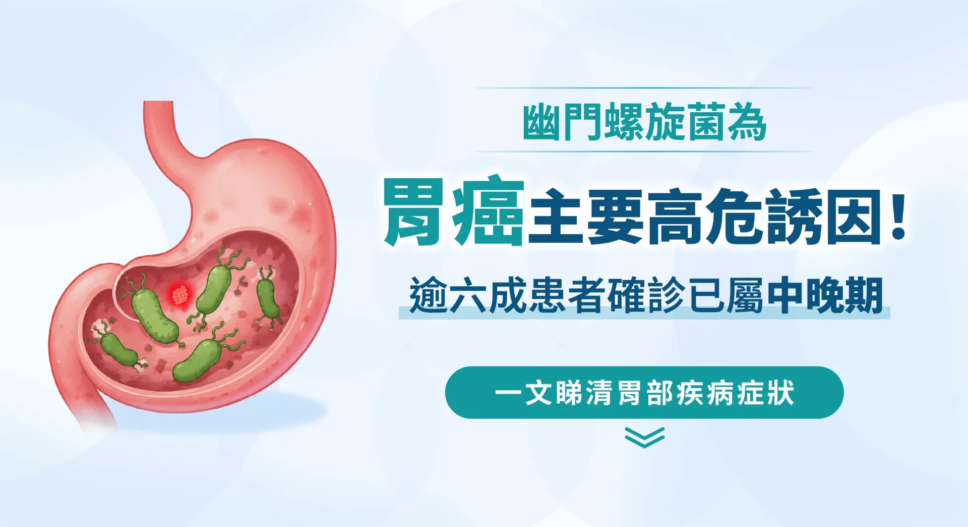 勿讓胃痛拖延成大病！把握黃金治療期
